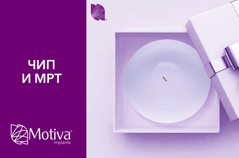 Фото - ТЕХНОЛОГІЯ РАДІОЧАСТОТНОЇ ІДЕНТИФІКАЦІЇ Q INSIDE™ SAFETY TECHNOLOGY (RFID-M)