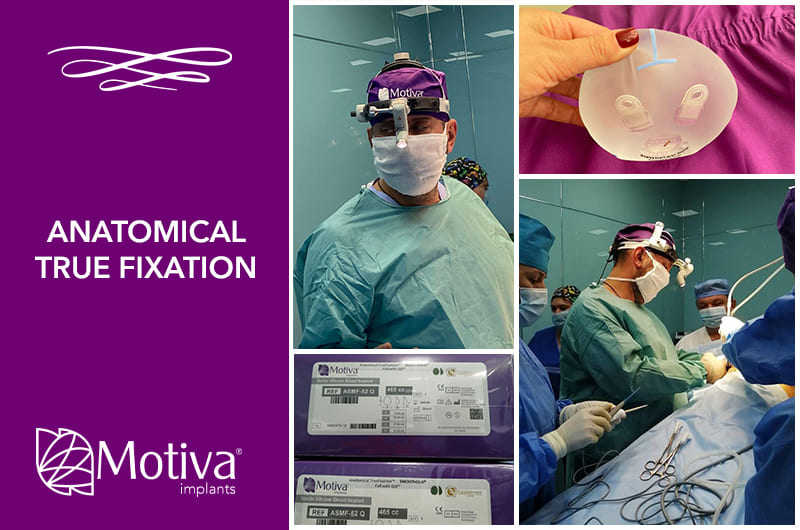 Доктор Андрей Леонидович Харьков: установка имплантов Anatomical TrueFixation. Фото - Доктор Андрей Леонидович Харьков: установка имплантов Anatomical TrueFixation.