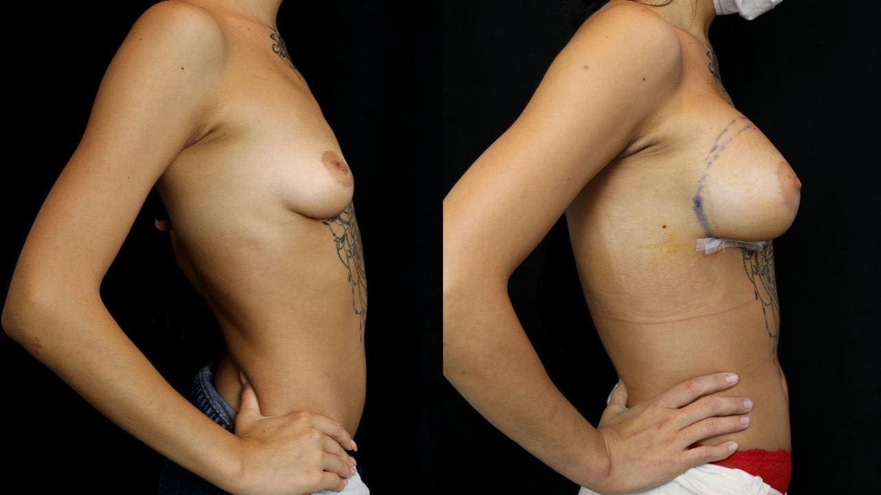 Фото - Доктор Андрій Леонідович Харьков : установка имплантатів Anatomical TrueFixation.