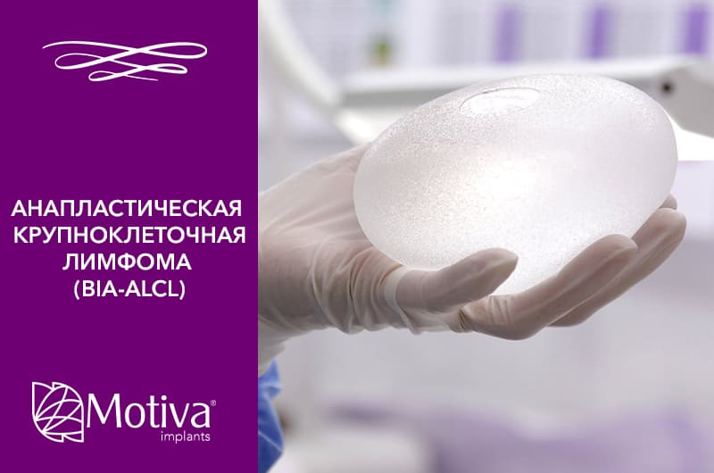 Анапластическая крупноклеточная лимфома (BIA-ALCL) Анапластическая крупноклеточная лимфома (BIA-ALCL)