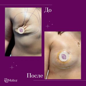 Благотворительная акция с участием ТМ Motiva Фото - Благотворительная акция с участием ТМ Motiva