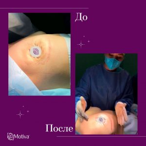 Благотворительная акция с участием ТМ Motiva Фото - Благотворительная акция с участием ТМ Motiva