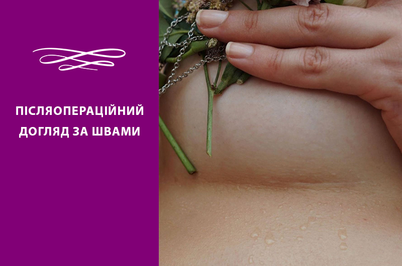 ПІСЛЯОПЕРАЦІЙНИЙ ДОГЛЯД ЗА ШВАМИ Фото - ПІСЛЯОПЕРАЦІЙНИЙ ДОГЛЯД ЗА ШВАМИ