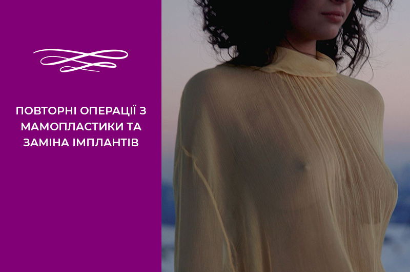 Повторні операції з мамопластики та заміна імплантів Фото - Повторні операції з мамопластики та заміна імплантів